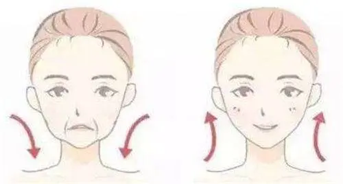 法令纹去除最好的方法