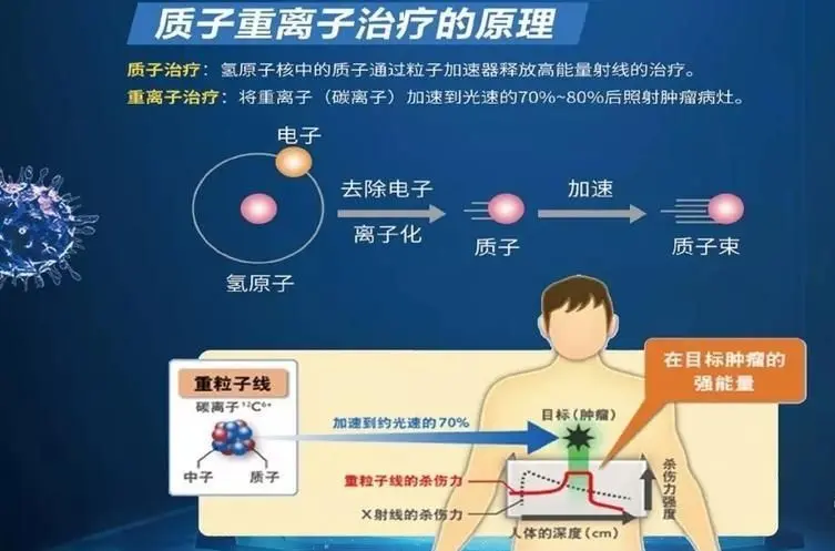 已经在多个国家建立了质子重粒子治疗中心，并正在进行多种肿瘤的治疗。
