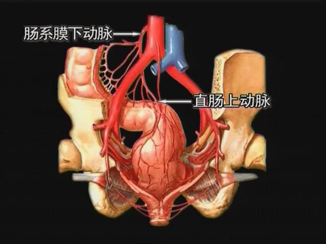 直肠血供:直肠上动脉,直肠下动脉,骶正中动脉,肛动脉