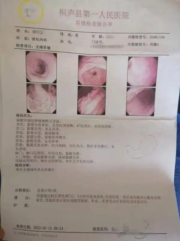 中度肠化逆转！30岁男子胃胀胃痛太难受，中医辨证论治帮助改善