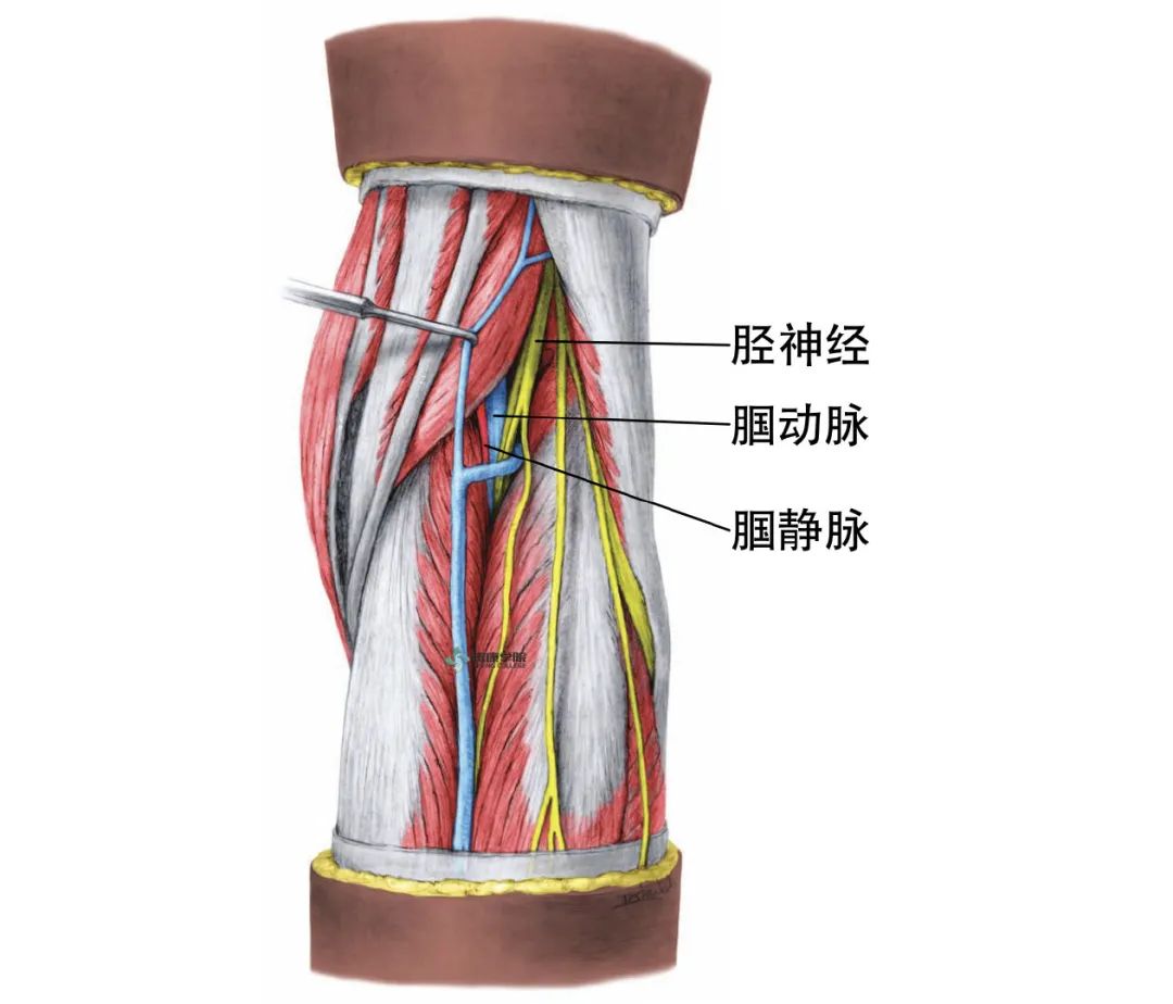 胫神经解剖及临床检查