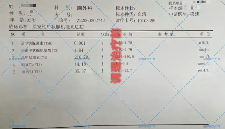 甲亢逐步恢复正常——分享一组治疗甲亢的验方