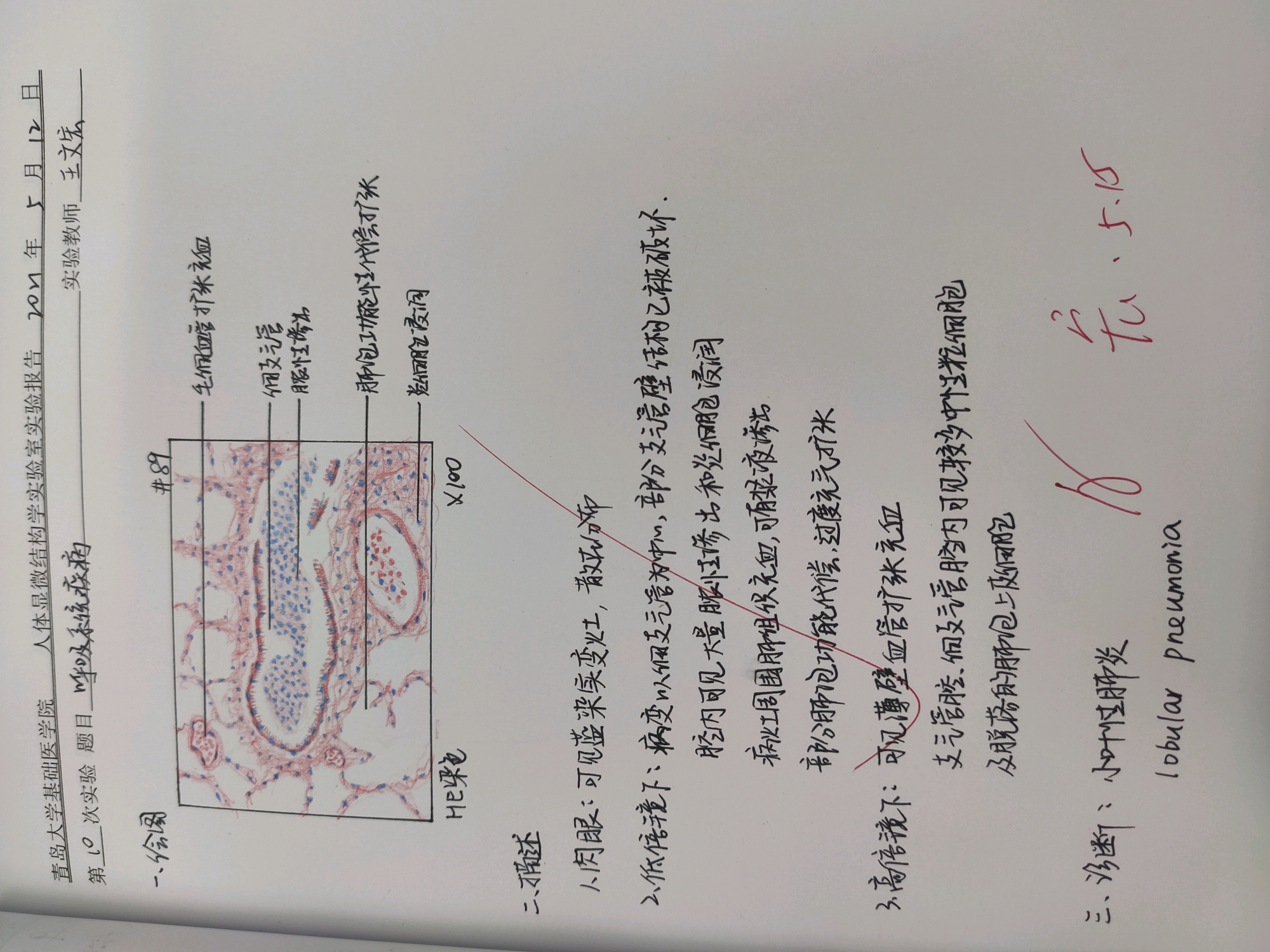 病理学实验报告