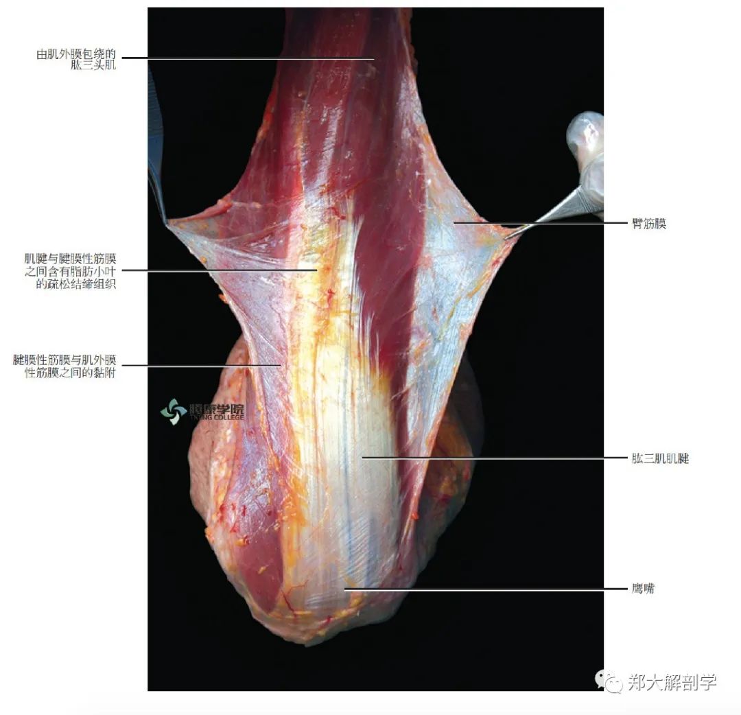 腱膜性筋膜是指所有的"包裹固定一组肌肉或在 肌肉的附着处发挥作用