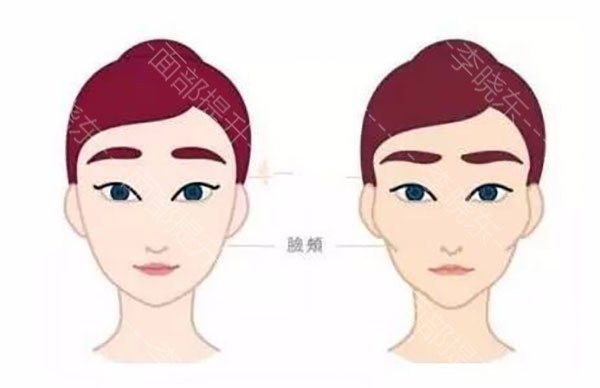 有没有什么办法可以让脸部提升 ecd43c7521c807627a1d4d2c8881015b14275ba8.jpg