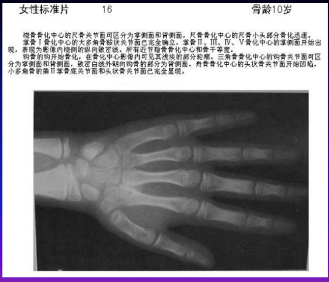 儿科主任带你解锁骨龄的"秘密"