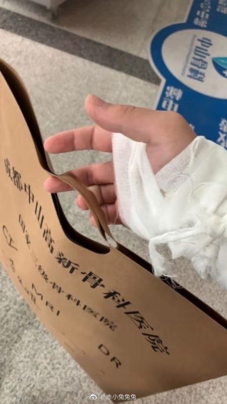 东东赛前腱鞘炎加右手手腕关节劳损,还去了一次医院,拍了手缠着纱布的