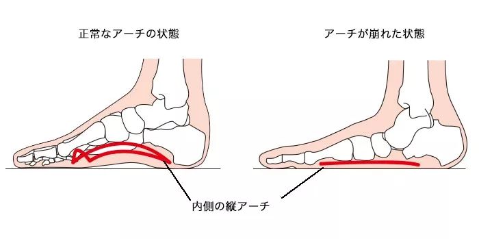 用动作模式构建足弓