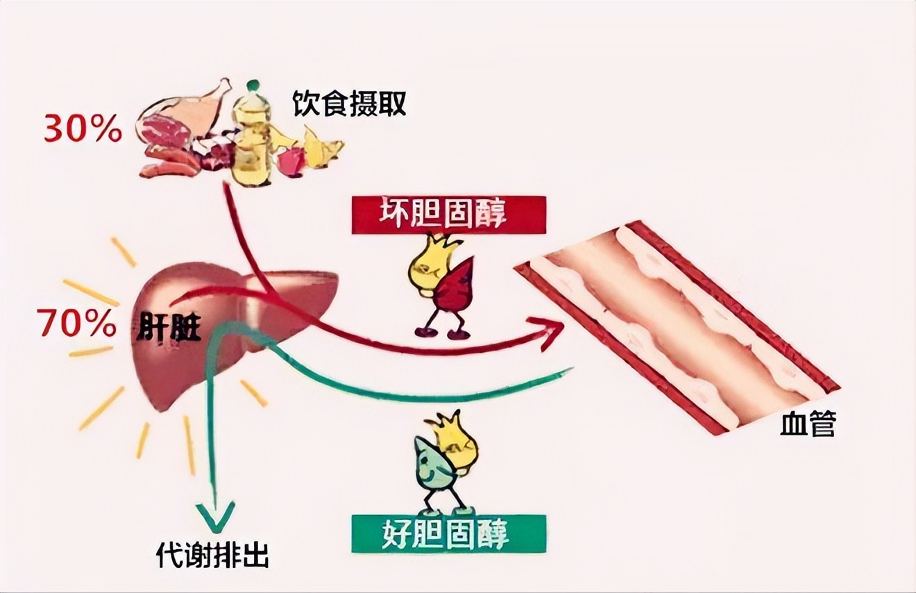 所以，治疗高血脂我们就得从健脾疏肝、化浊降脂入手，具体怎么做呢？今