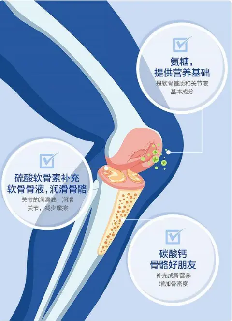 氨糖的正确服用方法？您了解多少呢？