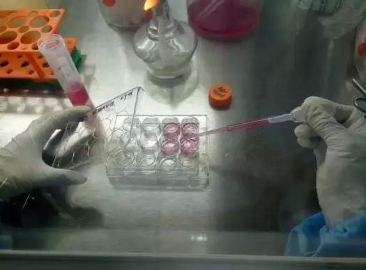 【生物科研protocol】原代细胞培养问题你该如何解决?