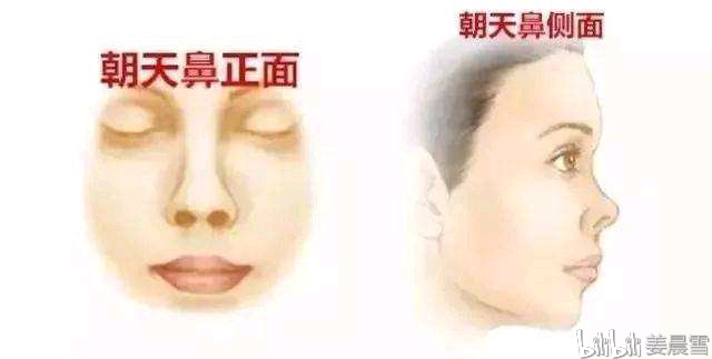 怎么样能让自己的鼻子变大 0690d7f3bc63050e5fe700e005c287bf43acf7b9.jpg