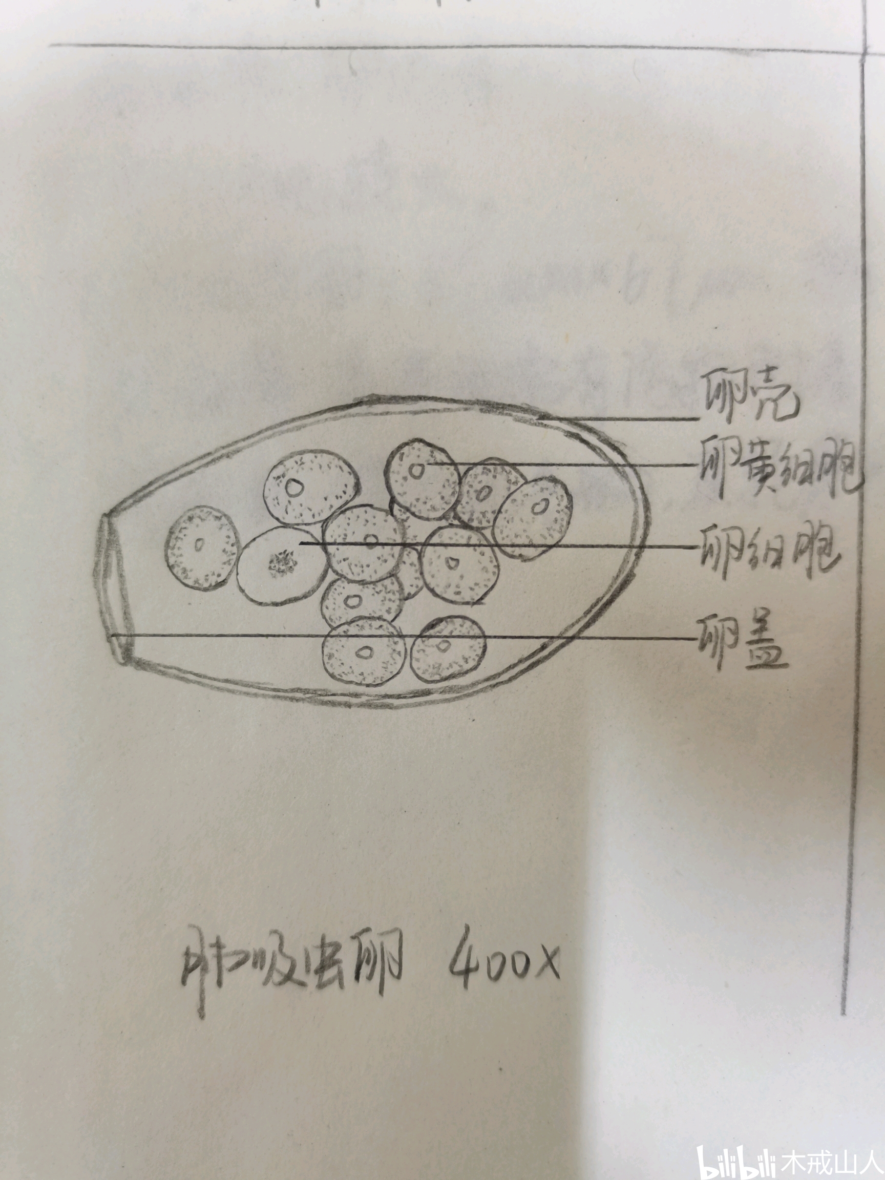 生活 日常 寄生虫手绘图——吸虫 光镜照片:400×