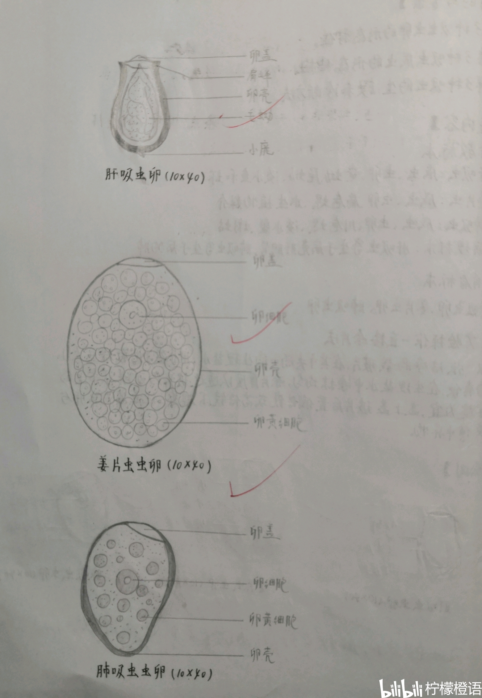 肝吸虫卵,姜片虫卵,肺吸虫卵