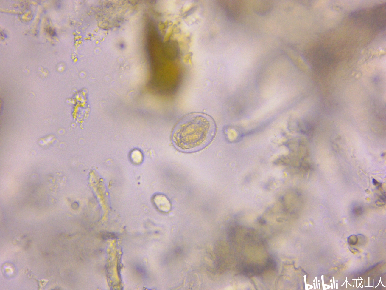 微小膜壳绦虫卵