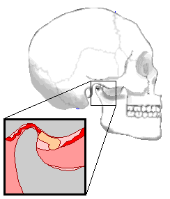 开口时,下颌骨的髁突和关节盘同步移动.