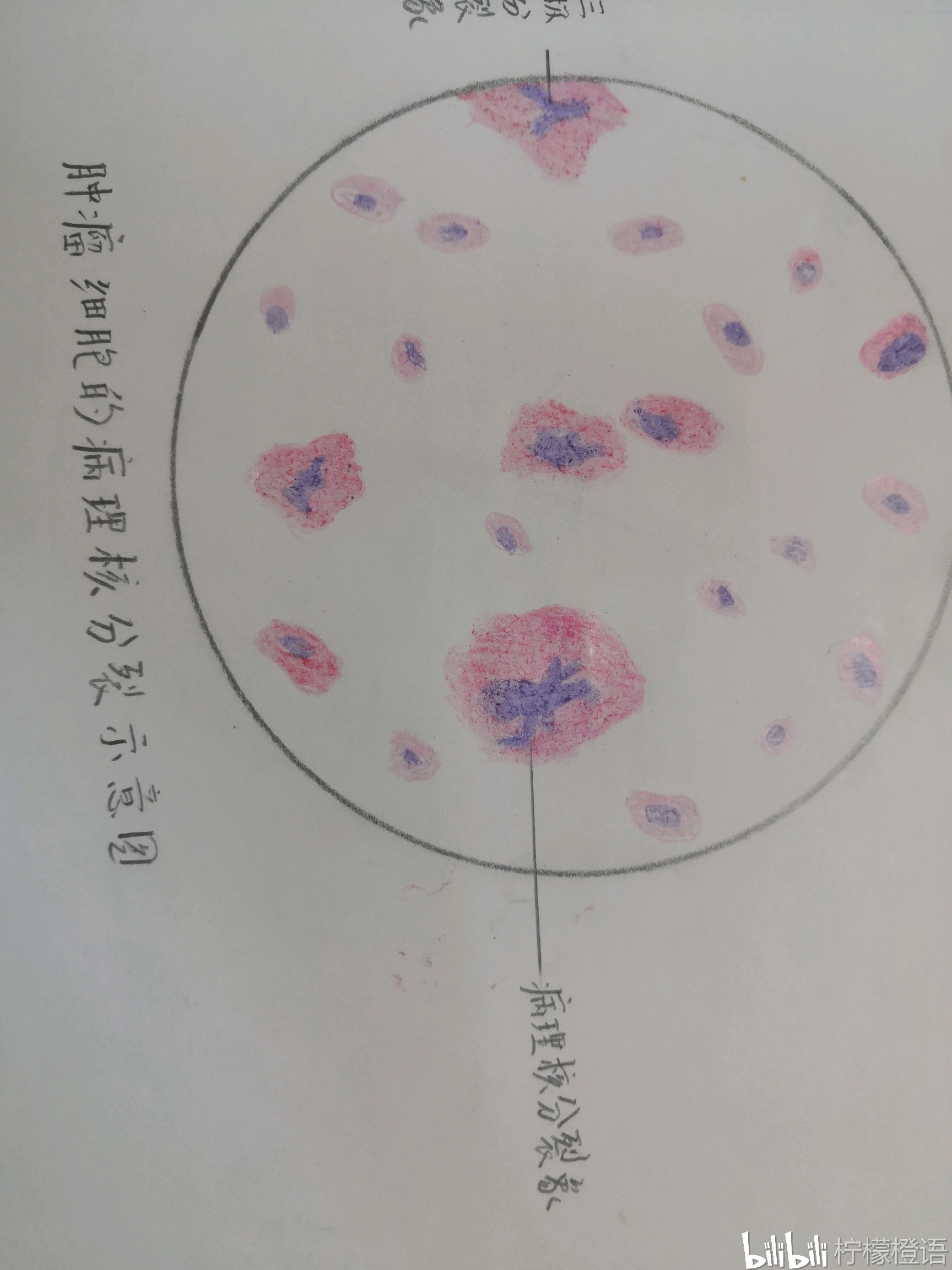 病理学实验手绘图