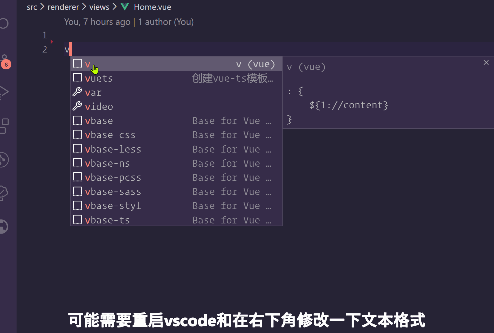 vscode中如何创建自己的代码段
