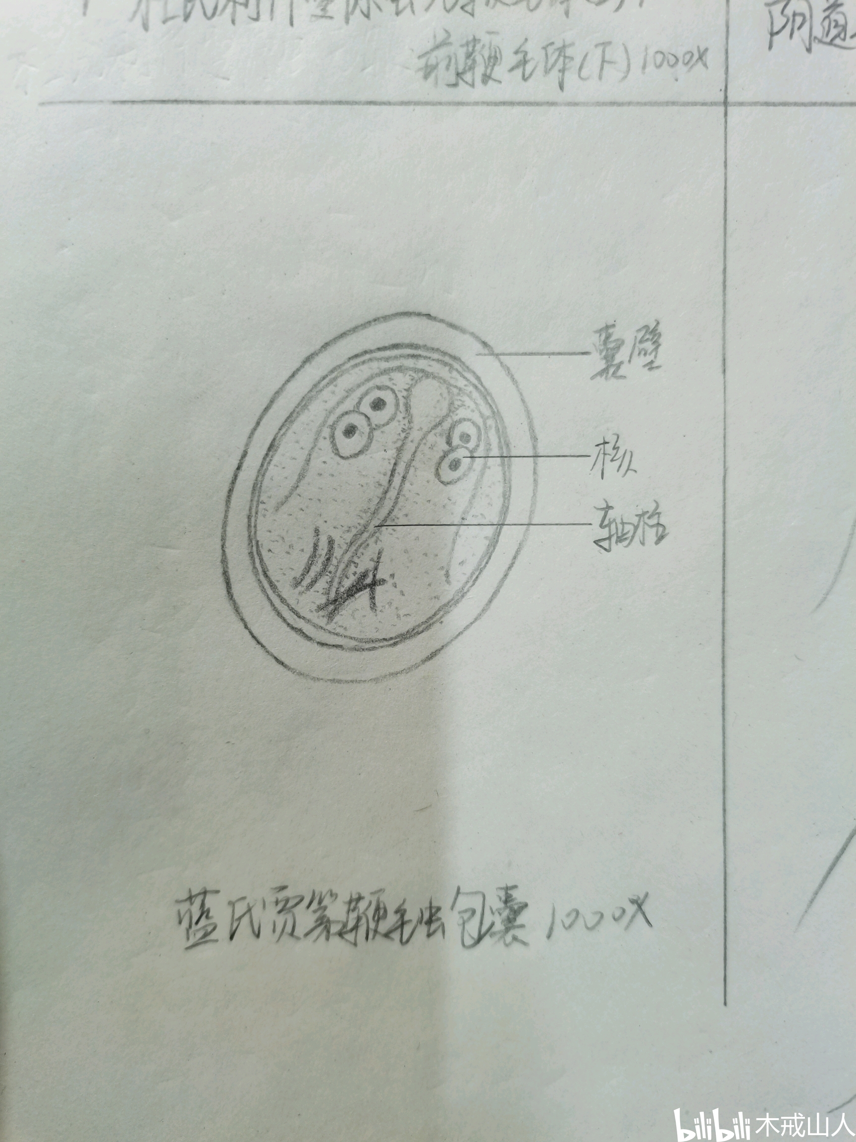 蓝氏贾第鞭毛虫包囊 1000