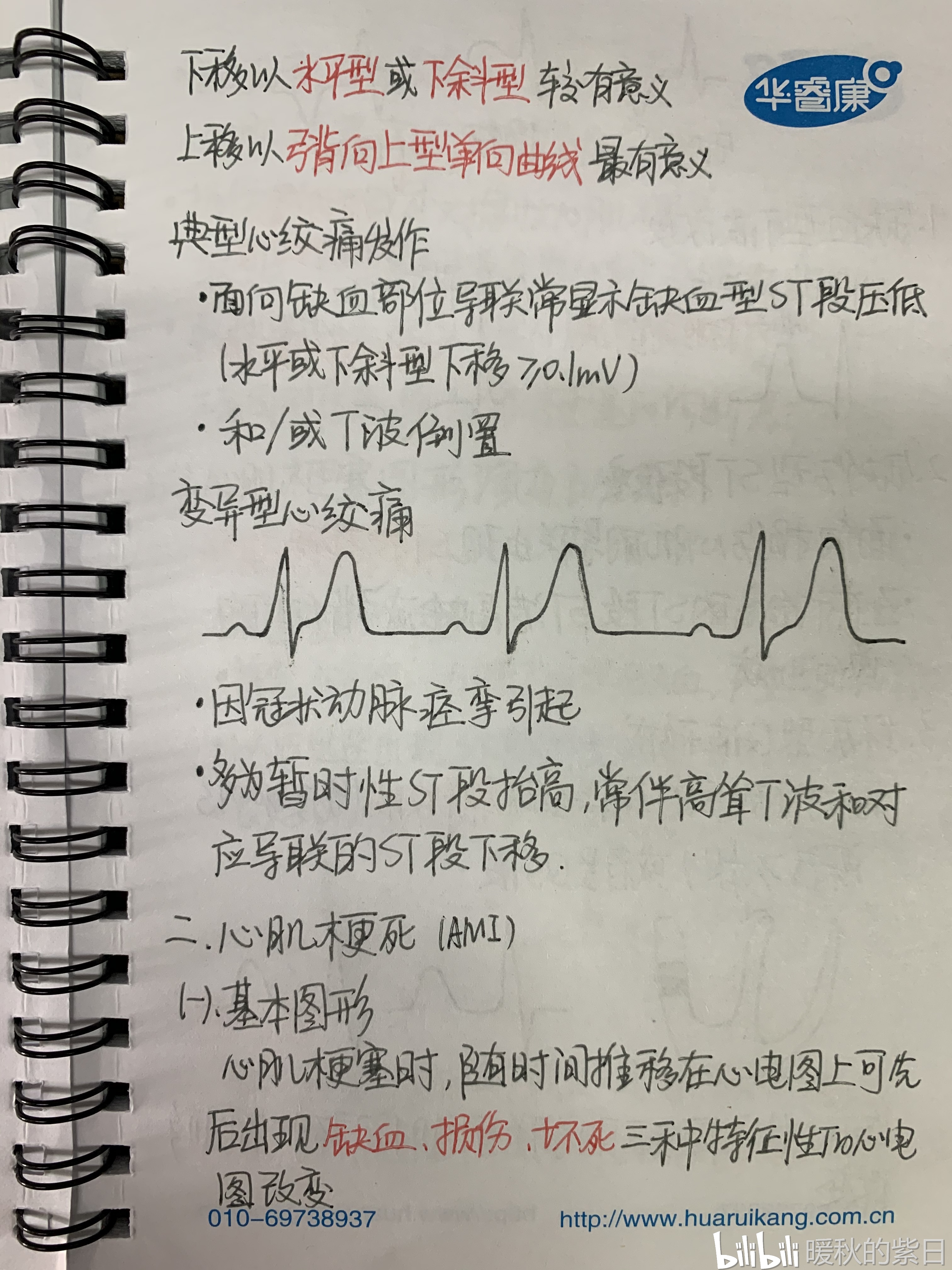 心电图笔记(配套视频bv1cc4y187qy)