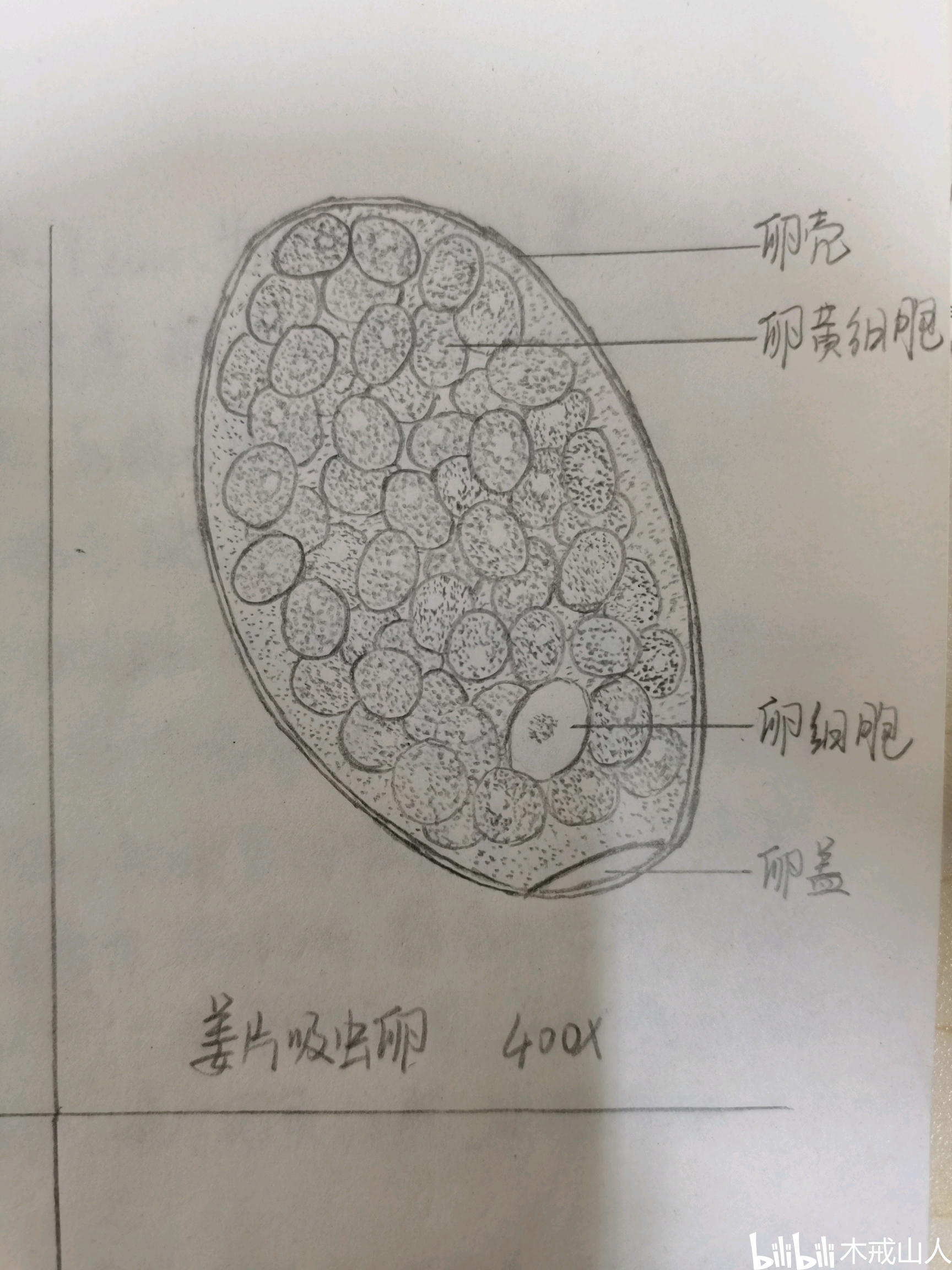 寄生虫手绘图—吸虫