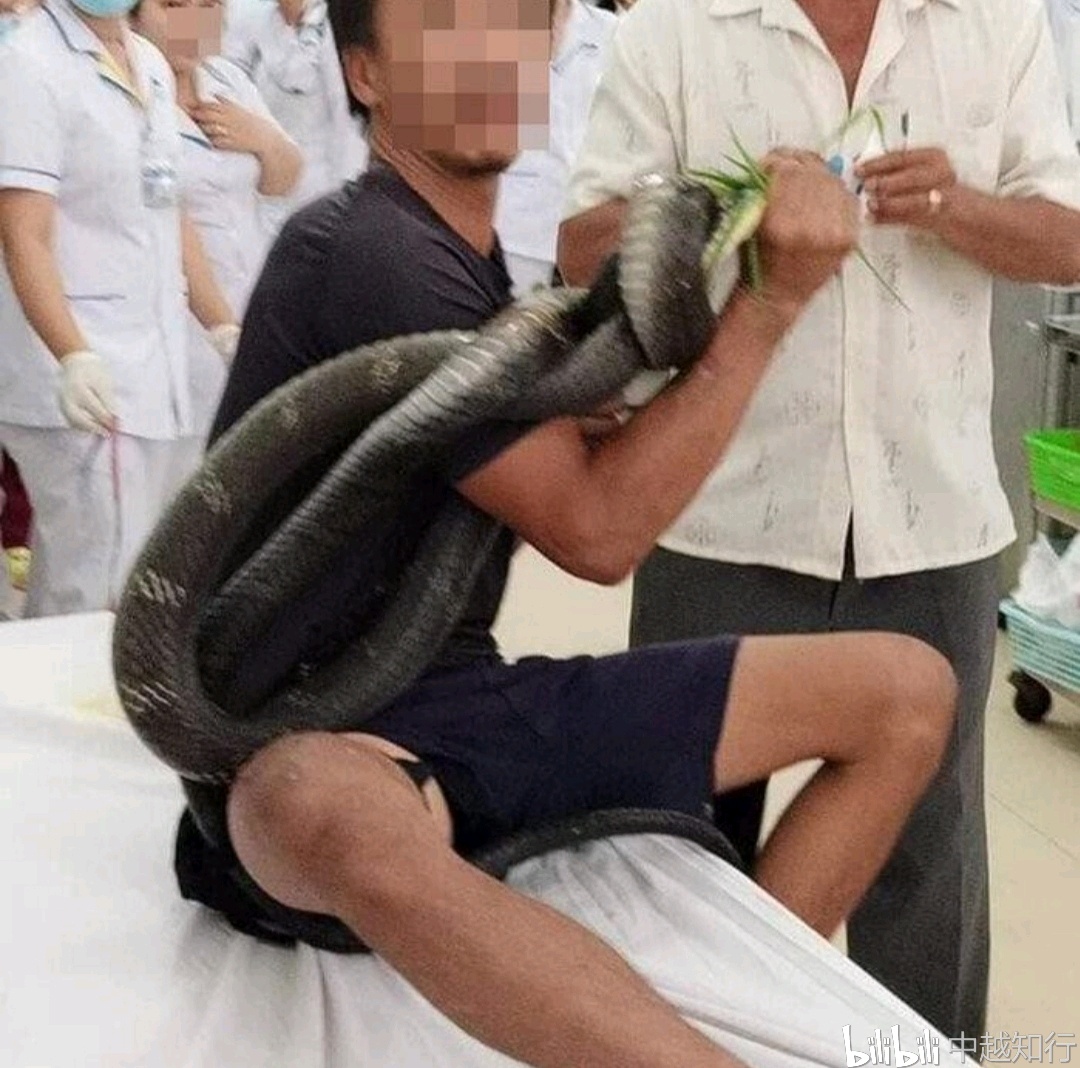 越南西宁省一名男子被眼镜蛇咬伤,男子抓住"肇事者"带到医院