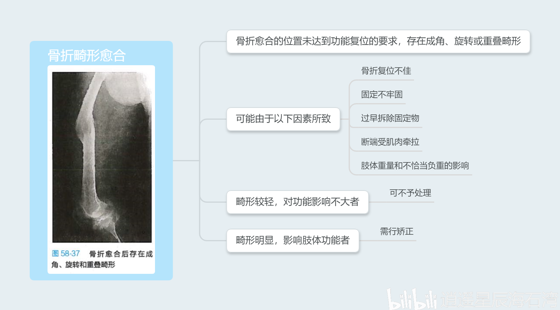 骨折畸形愈合