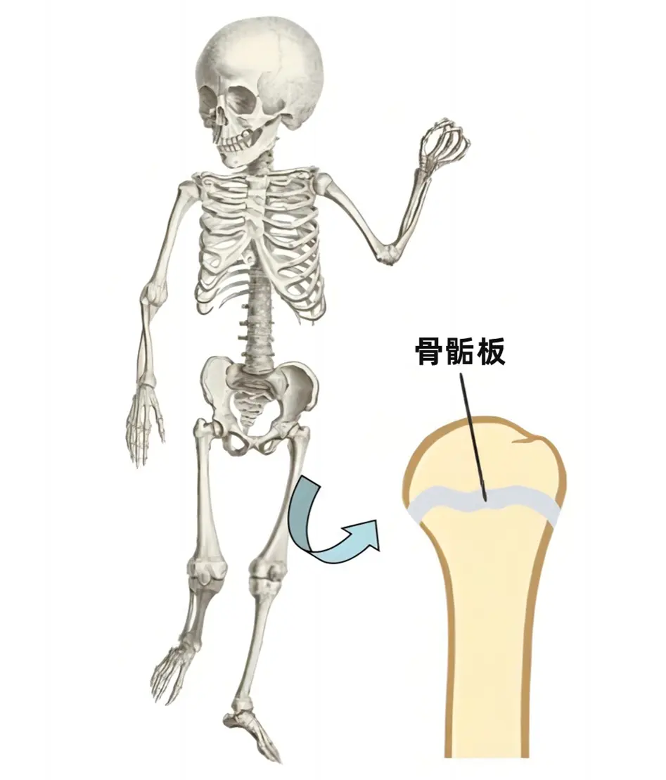 运动为什么可以促进骨骼变得强壮？
