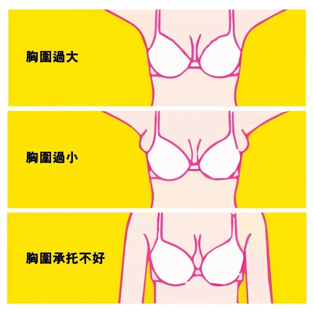 胸外扩