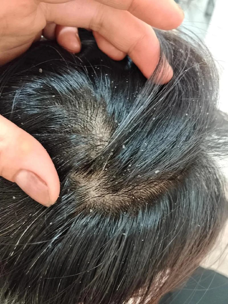 663559e46c866de017060e64a18911733546979068021010.png@1192w