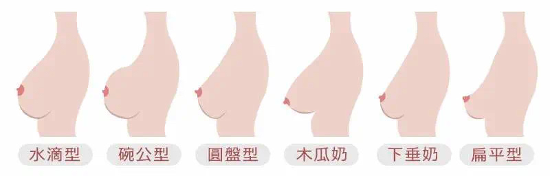 胸外扩