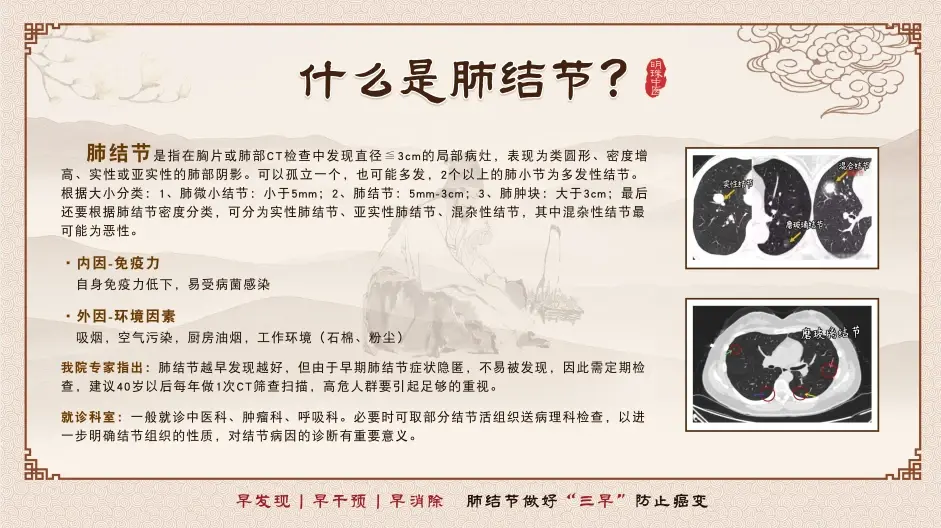 上海好的中医看肺结节医院？肺结节吃什么中药可以散结？上海肺结节哪个医院看的好