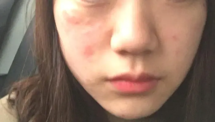 黛昂丝：安全护肤第一步 教你在家轻松进行护肤品过敏测试