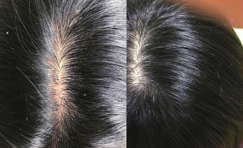 de89a989b0b27389971d80e4226f3df73632303808972844.png@1192w