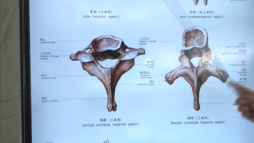 棘突分叉有椎体钩:锥体向上翘起横突有孔(椎a:横突孔变窄,椎动脉