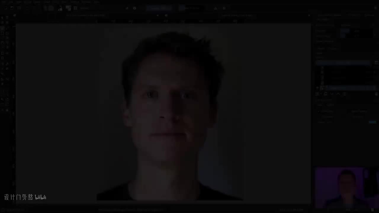 C01L16_面部不对称性