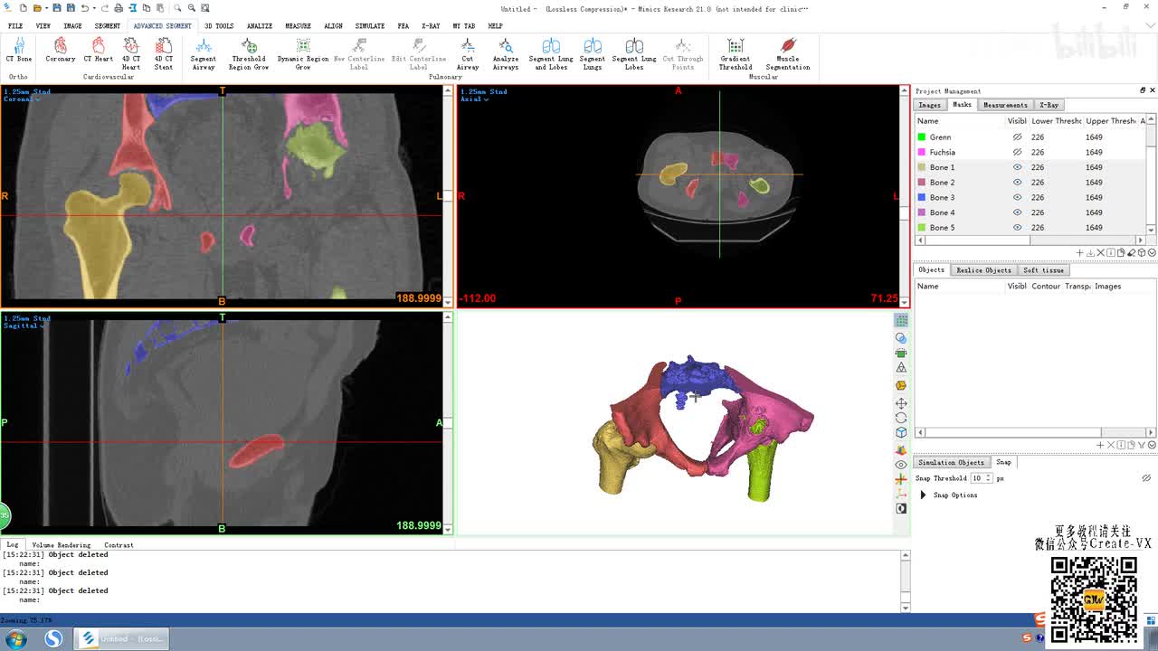 7-3、mimics21蒙版形态学（morphology操作）及3D interpolate命令讲解