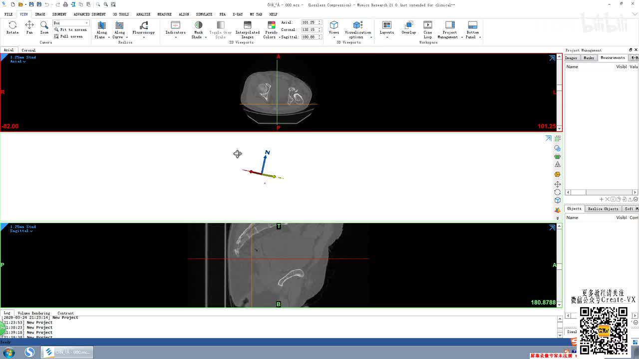 2-2、mimics21视图界面介绍讲解2