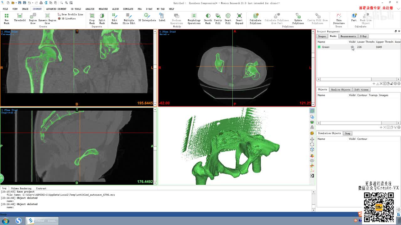 5-2、mimics21蒙版创建工具栏讲解2