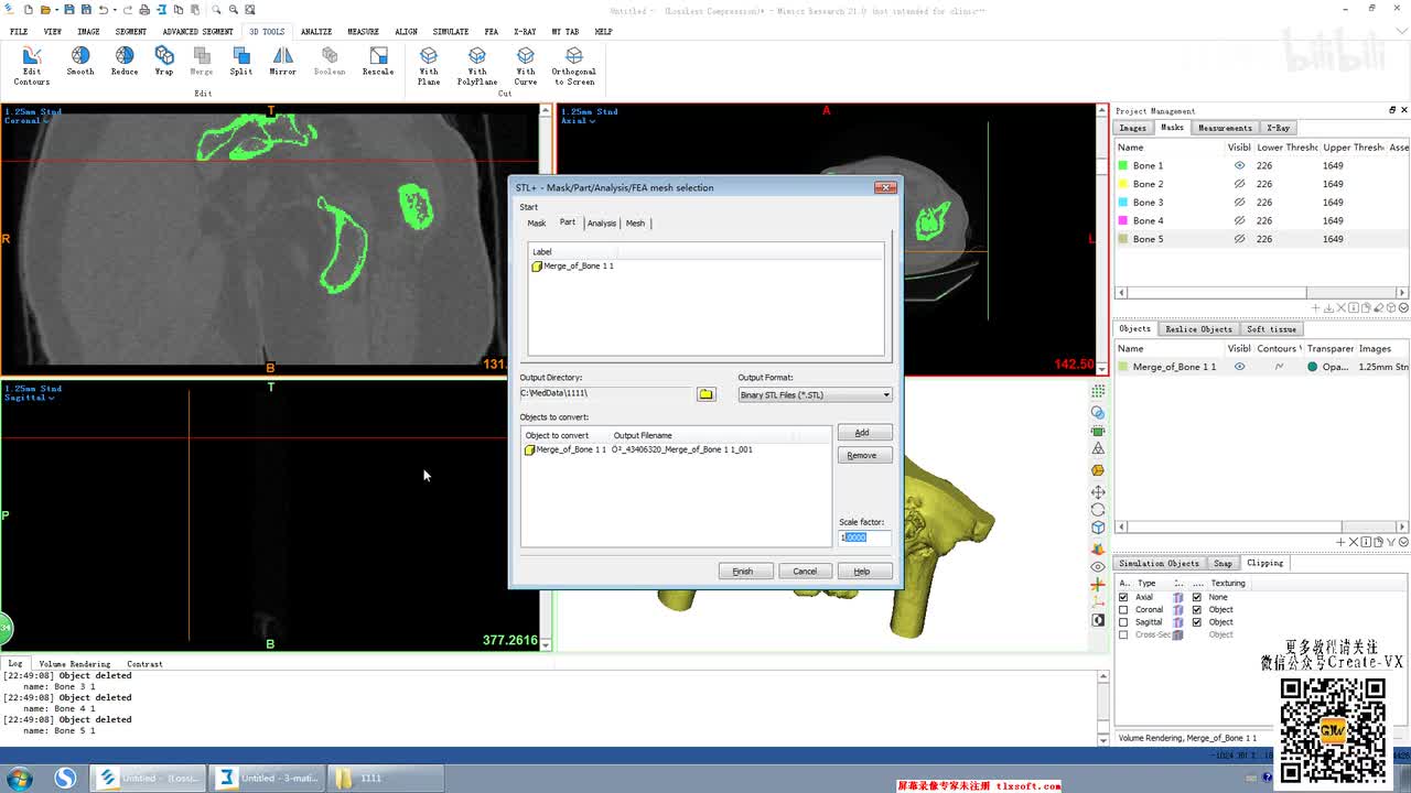10-5、mimics21之3D tool工具栏 - mirror命令讲解