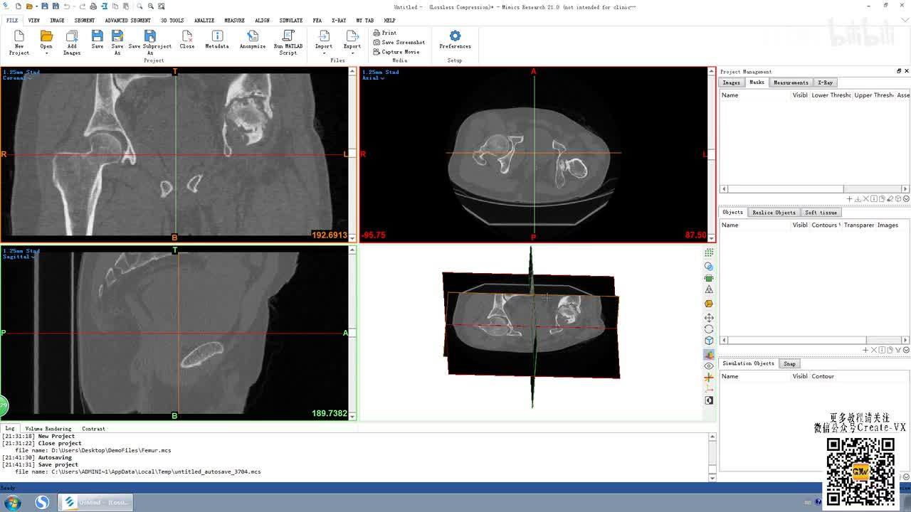 9、mimics21 ANALZE菜单（原版MadCAD功能）讲解