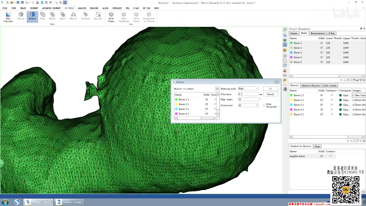 10-3、mimics21之3D tool工具栏 - wrap命令讲解