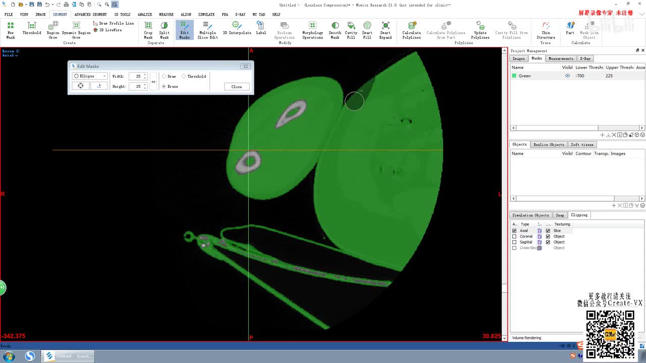 6-3、mimics21多层蒙版编辑（multiple slice edit )3