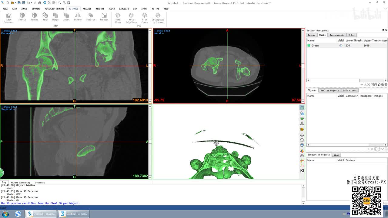 10-4、mimics21之3D tool工具栏 - merge及split命令讲解