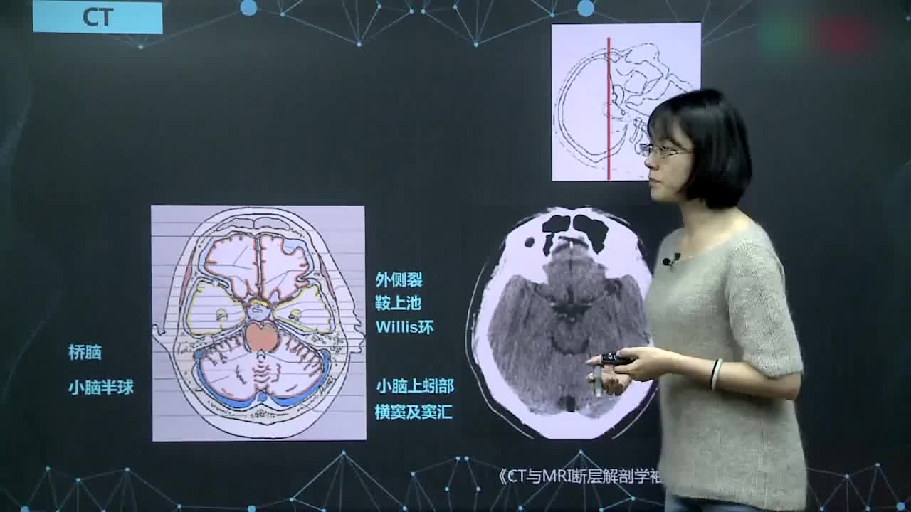 颅脑正常影像学表现（下）