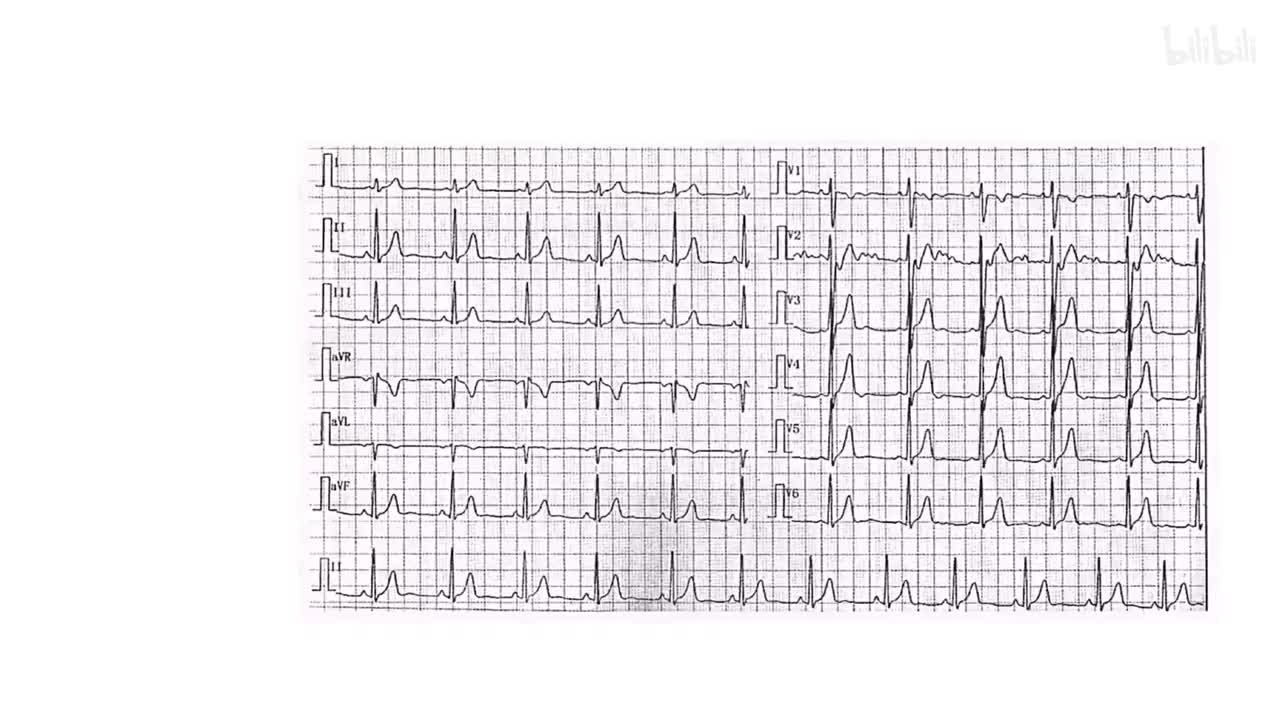 2/8) 一整套动作下来就两分钟