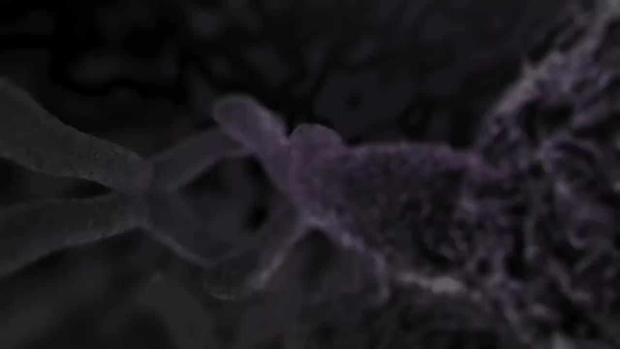 子宫内膜异位 20-Endometriosis