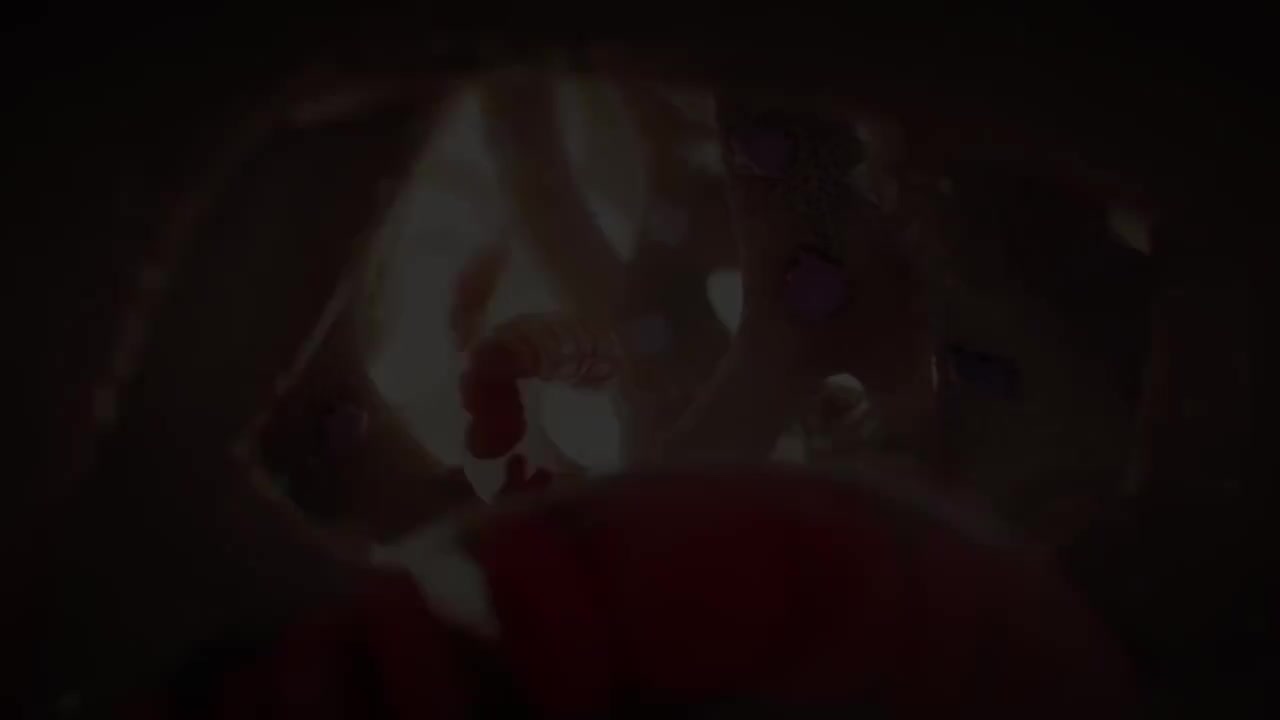 骨盆脱垂 34-Pelvic Prolapse Nucleus Health