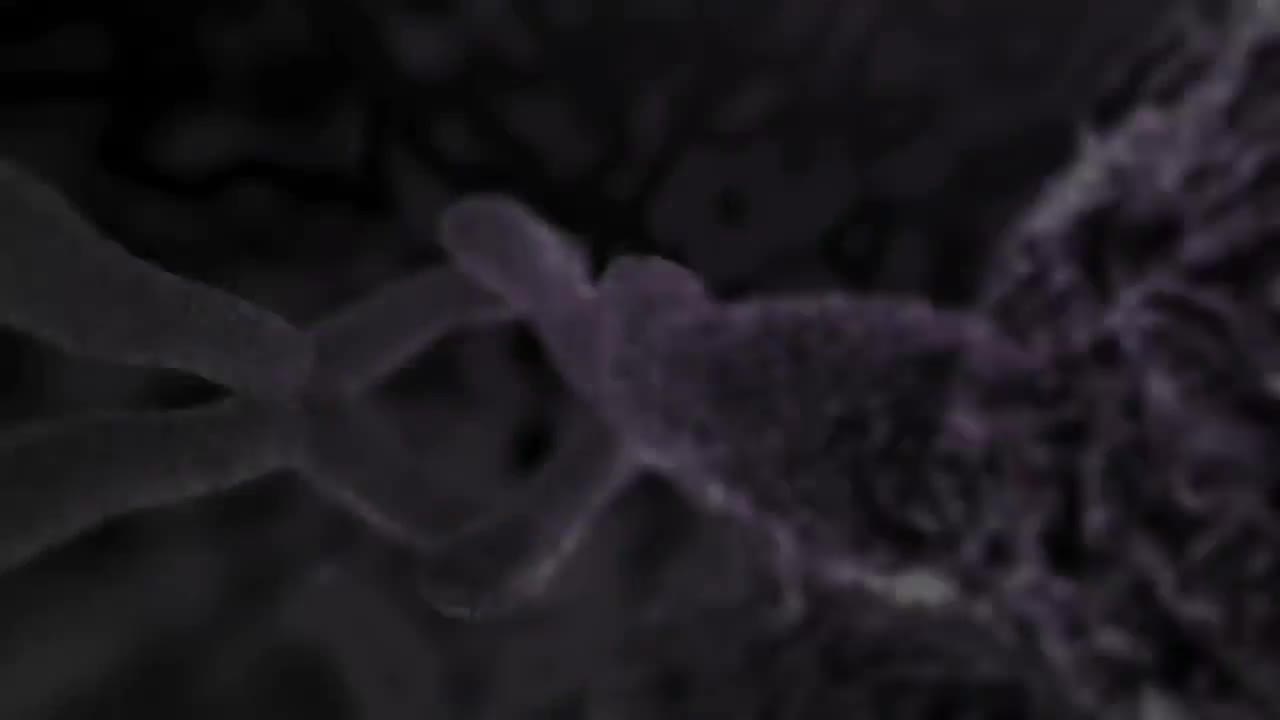 溃疡 77-Stomach Ulcer Nucleus Health