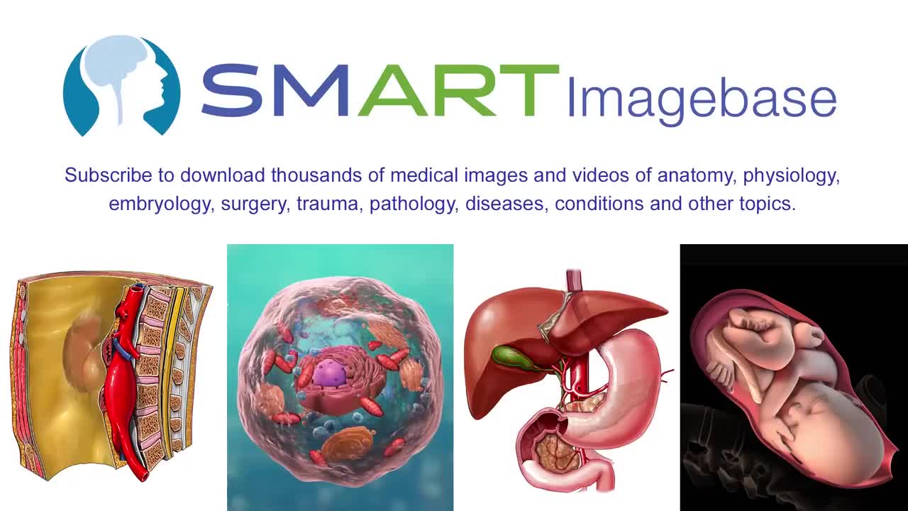 耻骨上导管护理出院说明 87-Suprapubic Catheter Care Discharge Instructions